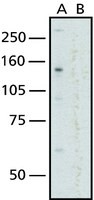 Anti-Nuclear Pore Complex Proteins antibody, Mouse monoclonal, clone 414, purified from hybridoma cell culture