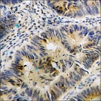 Anti-phospho-FAK (pTyr397) antibody produced in rabbit, affinity isolated antibody