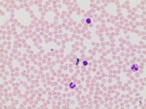 May-GrÃ¼nwald Stain