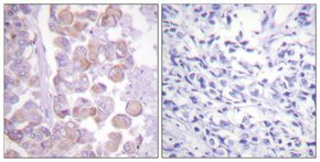 Anti-Synuclein antibody produced in rabbit, affinity isolated antibody